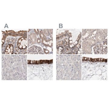 Anti-UFC1 antibody produced in rabbit Prestige Antibodies&#174; Powered by Atlas Antibodies, affinity isolated antibody, buffered aqueous glycerol solution, ab1