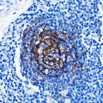 Anti-p75NTR/NGFR Antibody, clone 2H6Q6, Rabbit Monoclonal