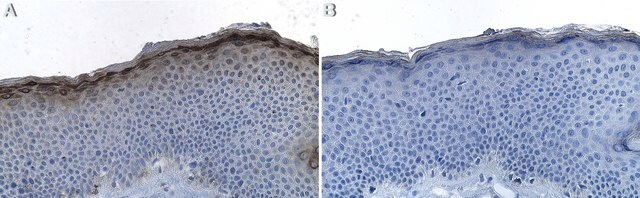 Anti-Filaggrin Antibody, clone AHF2