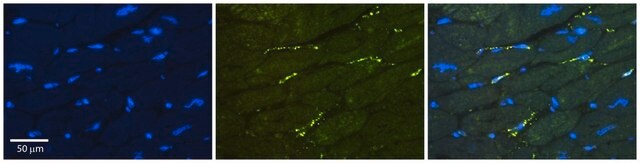 Anti-GREB1 (ab1) antibody produced in rabbit affinity isolated antibody