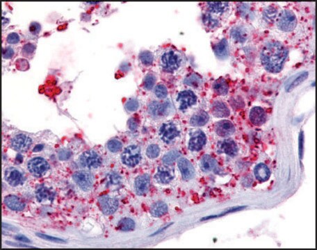 Anti-PRKWNK1 (AB2) antibody produced in rabbit affinity isolated antibody, buffered aqueous solution