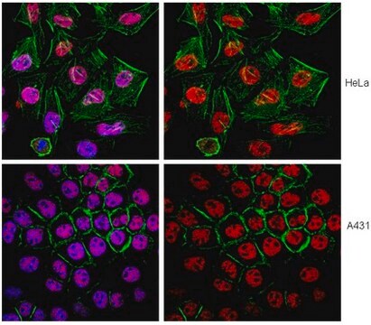 Anti-SMARCA4 Antibody, clone 20C3.2 clone 20C3.2, from mouse