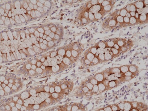 Anti-CEA (CD66e) antibody, Rabbit monoclonal recombinant, expressed in HEK 293 cells, clone RM326, purified immunoglobulin