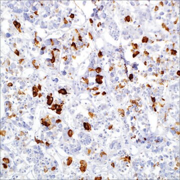 Prolactin Rabbit Polyclonal Antibody