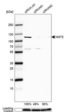 Anti-NMT2 antibody produced in rabbit Prestige Antibodies&#174; Powered by Atlas Antibodies, affinity isolated antibody, buffered aqueous glycerol solution