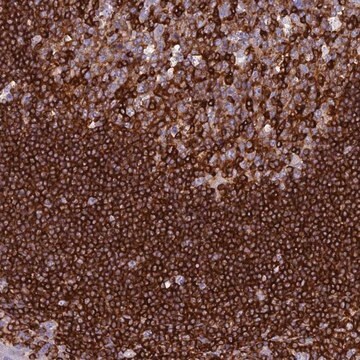 Anti-ABI3BP antibody produced in rabbit Prestige Antibodies&#174; Powered by Atlas Antibodies, affinity isolated antibody, buffered aqueous glycerol solution