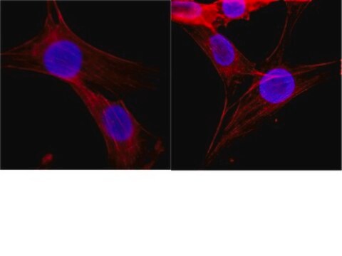 Anticorps anti-histone, clone&nbsp;H11-4 clone H11-4, Chemicon&#174;, from mouse