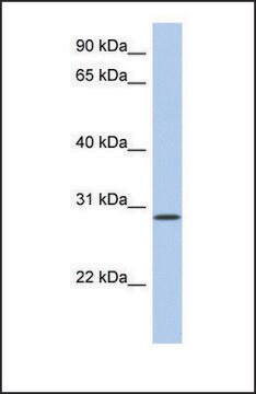 Anti-HAVCR2, (N-terminal) antibody produced in rabbit affinity isolated antibody