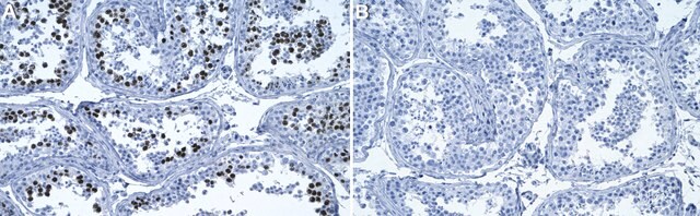 Anti-KIFC1 Antibody, clone 3M19 ZooMAb&#174; Rabbit Monoclonal recombinant, expressed in HEK 293 cells