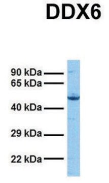 Anti-DDX6 (N-terminal) antibody produced in rabbit affinity isolated antibody