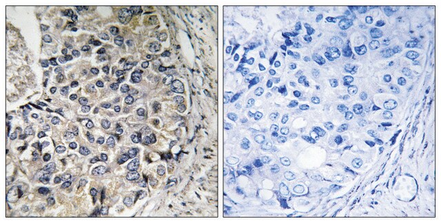 Anti-CMC1 antibody produced in rabbit affinity isolated antibody