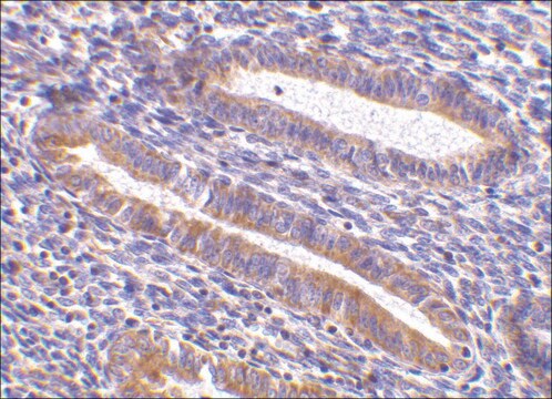 抗TIM-1抗体 ウサギ宿主抗体 affinity isolated antibody, buffered aqueous solution