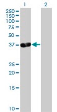 抗PDLIM3抗体 マウス宿主抗体 purified immunoglobulin, buffered aqueous solution