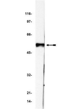 Anti-p53-Antikörper, Klon BP53-12 clone BP53-12, Upstate&#174;, from mouse