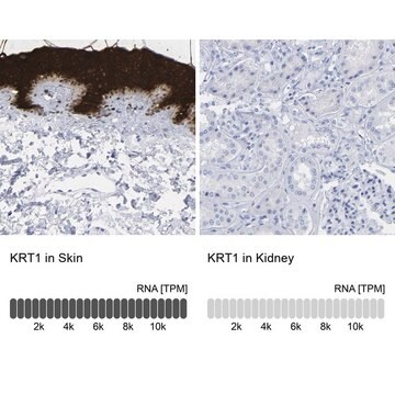 Anti-KRT1 antibody produced in rabbit Prestige Antibodies&#174; Powered by Atlas Antibodies, affinity isolated antibody, buffered aqueous glycerol solution