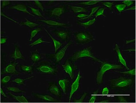 Monoclonal Anti-S100P antibody produced in mouse clone 1A11, purified immunoglobulin, buffered aqueous solution