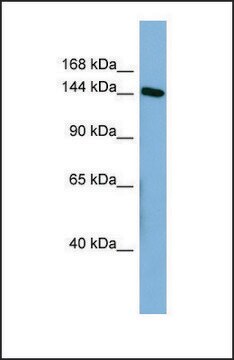 Anti-HDLBP antibody produced in rabbit affinity isolated antibody