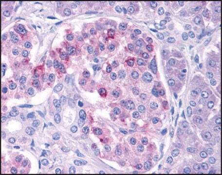 Anti-IKK&#949; antibody produced in rabbit affinity isolated antibody, buffered aqueous solution