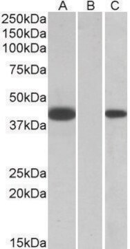 Anti-FANCF antibody produced in goat affinity isolated antibody, buffered aqueous solution