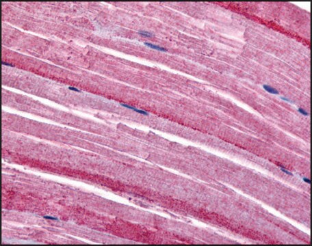 Anti-GRK5 antibody produced in rabbit affinity isolated antibody, buffered aqueous solution