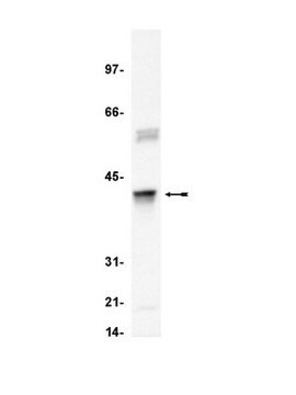 Anticuerpo anti-cadena &#945; de la clusterina (humana), clon 41D. clone 41D, Upstate&#174;, from mouse