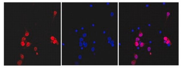 Anticuerpo anti-NeuN (monoclonal de conejo), clon 27-4 clone 27-4, from rabbit