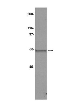 Anti-TACC2 Antibody Upstate&#174;, from rabbit