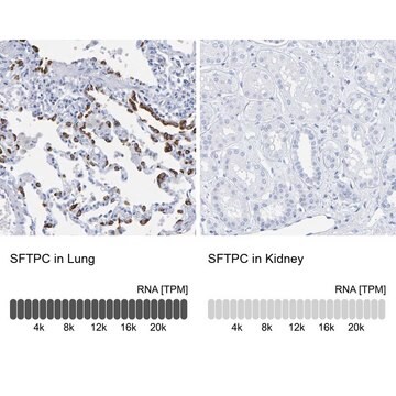 抗SFTPC ウサギ宿主抗体 Prestige Antibodies&#174; Powered by Atlas Antibodies, affinity isolated antibody, buffered aqueous glycerol solution, Ab1