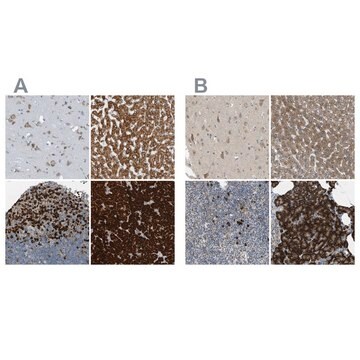 Anti-SSR1 antibody produced in rabbit Prestige Antibodies&#174; Powered by Atlas Antibodies, affinity isolated antibody, buffered aqueous glycerol solution