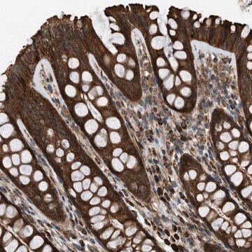 Anti-SESN2 antibody produced in rabbit Prestige Antibodies&#174; Powered by Atlas Antibodies, affinity isolated antibody, buffered aqueous glycerol solution