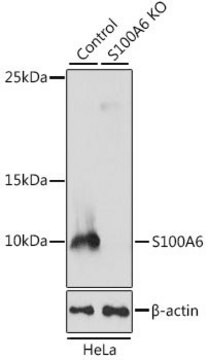 Anti-S100A6 antibody produced in rabbit