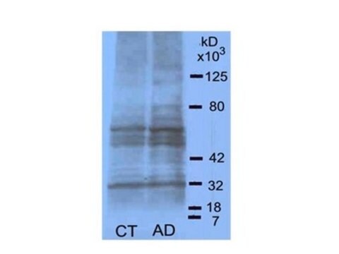 Anti-AGE (Advanced Glycation End-products) Antibody serum, Chemicon&#174;