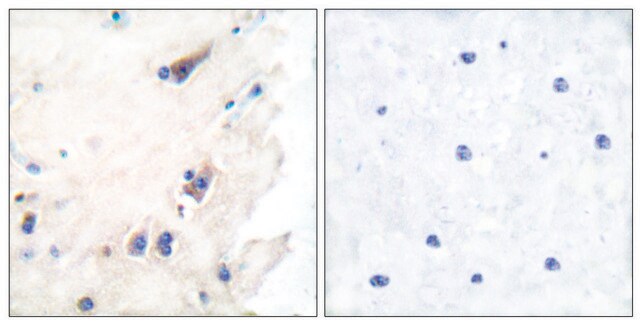 Anti-PLCB3 antibody produced in rabbit affinity isolated antibody