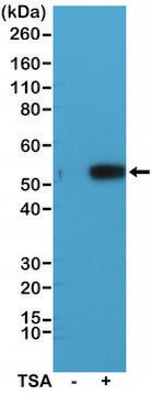 兔抗-乙酰-&#945;-微管蛋白（Lys40）单克隆抗体 recombinant, expressed in HEK 293 cells, clone RM318, purified immunoglobulin