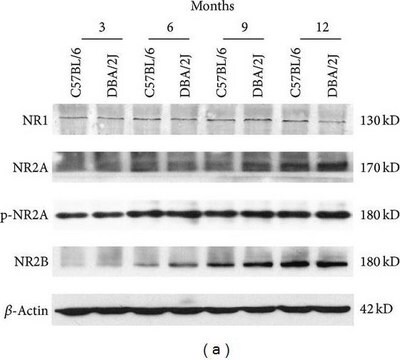 Anticuerpo anti-NR1, CT. Upstate&#174;, from mouse