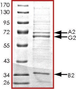 AMPK (&#945;2/&#946;2/&#947;2), active, His tagged human PRECISIO&#174; Kinase, recombinant, expressed in baculovirus infected Sf9 cells, &#8805;70% (SDS-PAGE), buffered aqueous glycerol solution