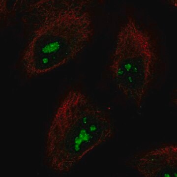 Anty-SMKR1 Prestige Antibodies&#174; Powered by Atlas Antibodies, affinity isolated antibody