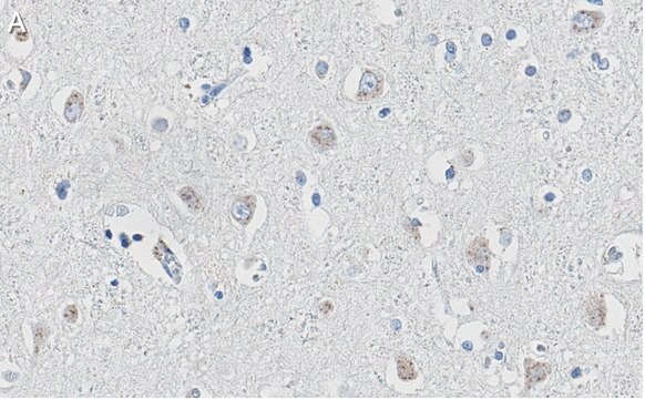 抗APP抗体 クローン1F22 ZooMAb&#174;ウサギモノクローナル recombinant, expressed in HEK 293 cells