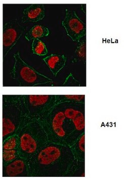 Anti-FUSE-binding protein 1 Antibody from rabbit, purified by affinity chromatography