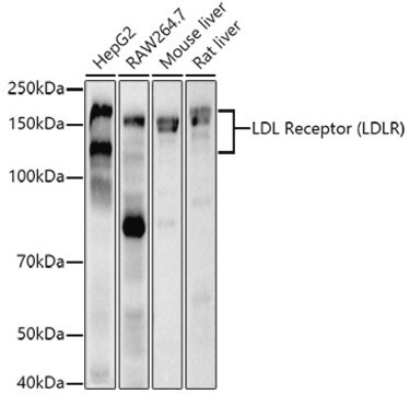 Anti-LDL Receptor (LDLR) Antibody, clone 10K4L8, Rabbit Monoclonal