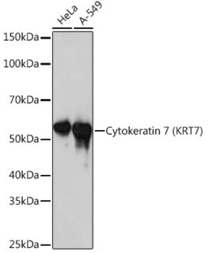 Anti-Cytokeratin 7 (KRT7) Antibody, clone 6Q1B4, Rabbit Monoclonal