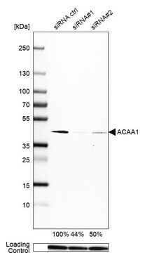 Monoclonal Anti-ACAA1 antibody produced in mouse Prestige Antibodies&#174; Powered by Atlas Antibodies, clone CL2663, purified immunoglobulin, buffered aqueous glycerol solution