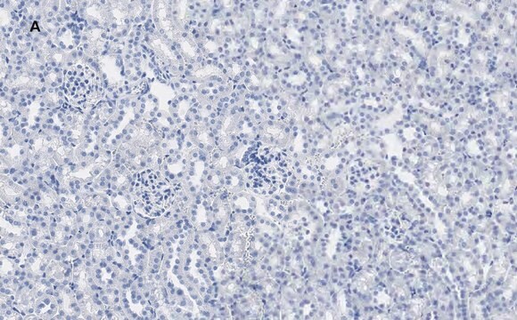 Anti-Calbindin D-28K clone 1A11 Antibody, ZooMAb&#174; Rabbit Monoclonal recombinant, expressed in HEK 293 cells