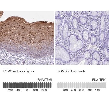 抗TGM3 ウサギ宿主抗体 Prestige Antibodies&#174; Powered by Atlas Antibodies, affinity isolated antibody, buffered aqueous glycerol solution