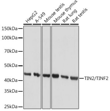 Anti-TIN2/TINF2 Antibody, clone 4W5P2, Rabbit Monoclonal