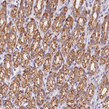 Anti-FAM193A antibody produced in rabbit Prestige Antibodies&#174; Powered by Atlas Antibodies, affinity isolated antibody, buffered aqueous glycerol solution