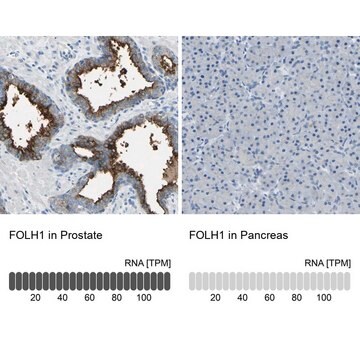 Anti-FOLH1 antibody produced in rabbit Prestige Antibodies&#174; Powered by Atlas Antibodies, affinity isolated antibody, buffered aqueous glycerol solution