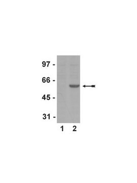 Anticorpo anti-fosfo-Smad2 (Ser465/467), clone A5S, monoclonale di coniglio culture supernatant, clone A5S, Upstate&#174;