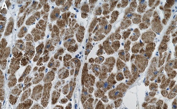 Anti-OXCT1 Antibody, clone 1B11 ZooMAb&#174; Rabbit Monoclonal recombinant, expressed in HEK 293 cells