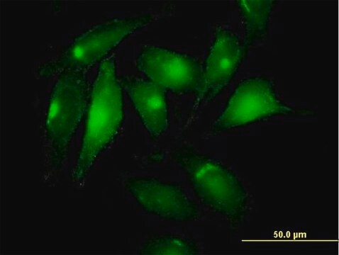 Anti-MSLN antibody produced in mouse purified immunoglobulin, buffered aqueous solution